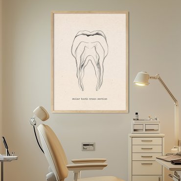 plakat dentysta przekrój zęba trzonowego